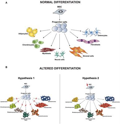 Three-Dimensional Patient-Derived In Vitro Sarcoma Models: Promising Tools for Improving Clinical Tumor Management